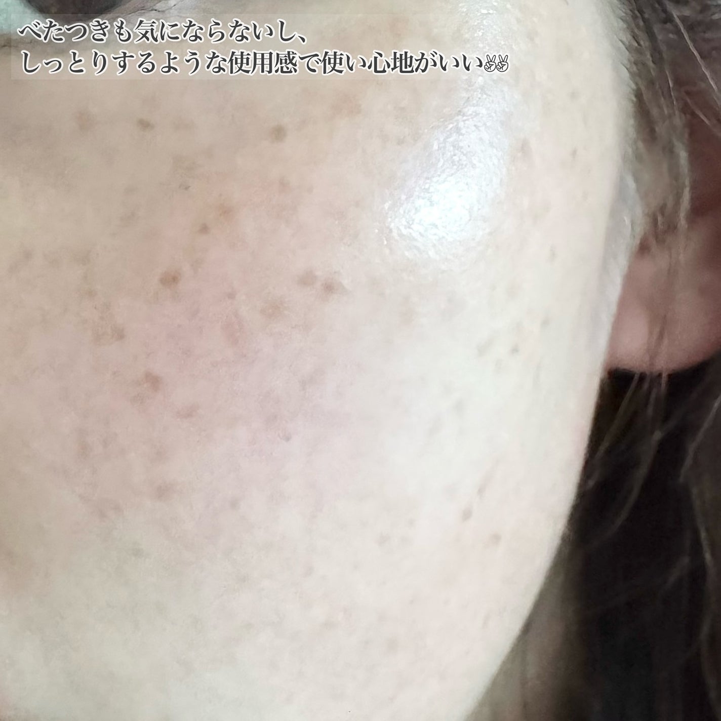 メディダーマ スレッドリフトクリーム/メディダーマ/フェイスクリームを使ったクチコミ(5枚目)