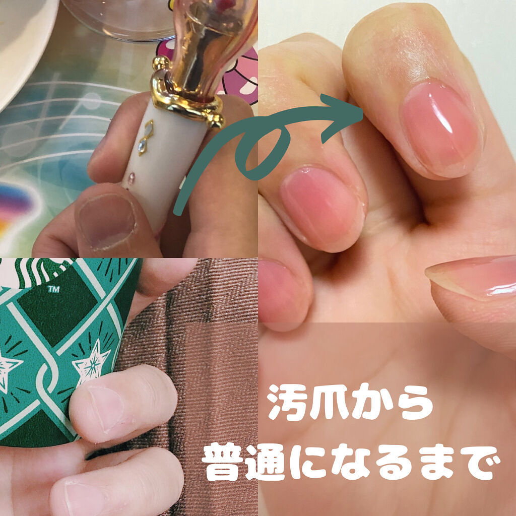 ジェルボリュームトップコート/キャンメイク/ネイルトップコートを使ったクチコミ（1枚目）