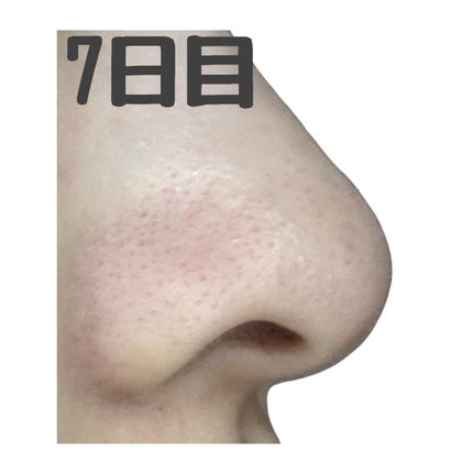 スキンコンディショナー高保湿/CEZANNE/化粧水を使ったクチコミ(5枚目)