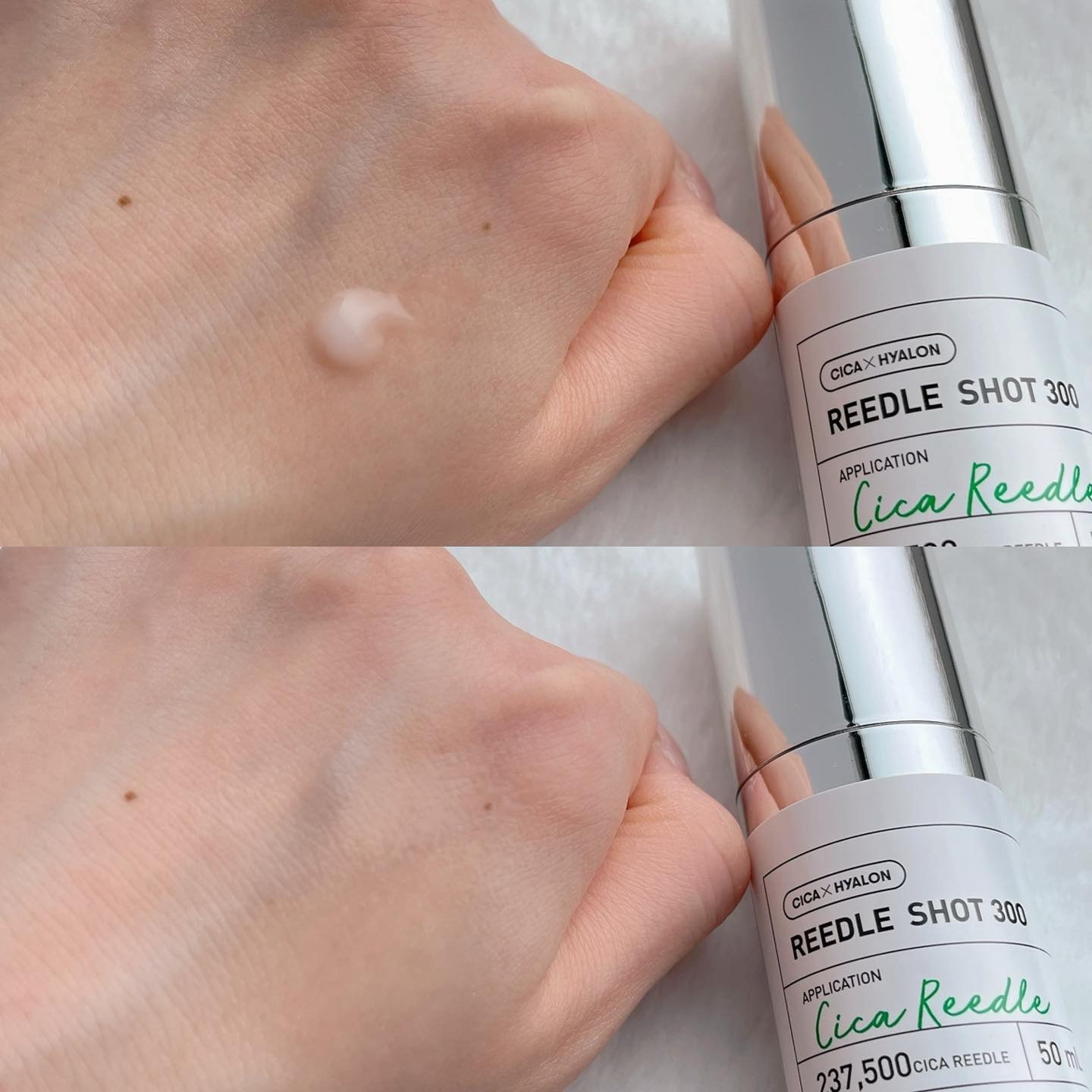 リードルショット300/VT/美容液を使ったクチコミ（3枚目）