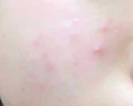 スキンコンディショナー/CEZANNE/化粧水を使ったクチコミ(2枚目)