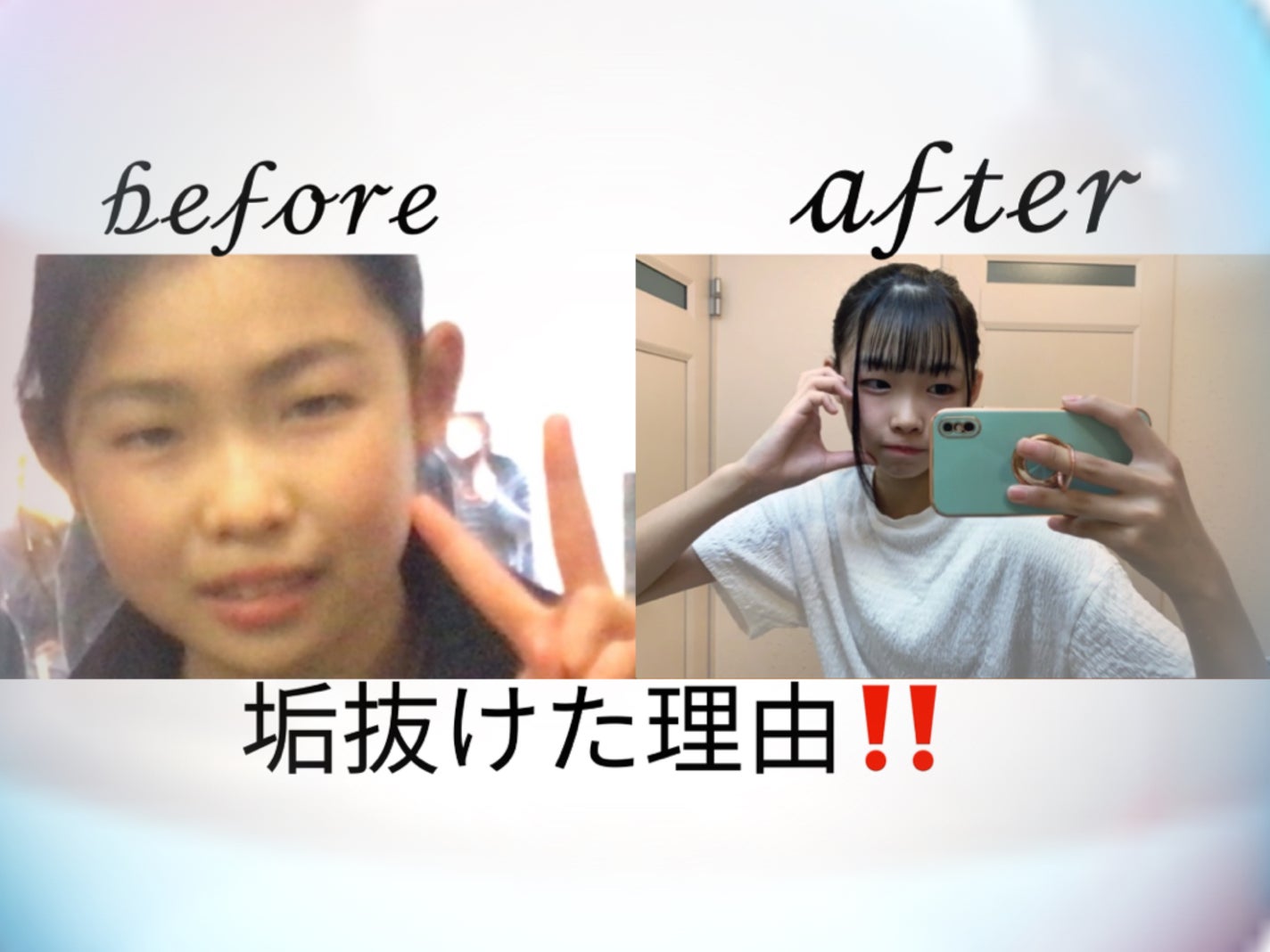 コンフォート リップオイル /CLARINS/リップグロスを使ったクチコミ(1枚目)