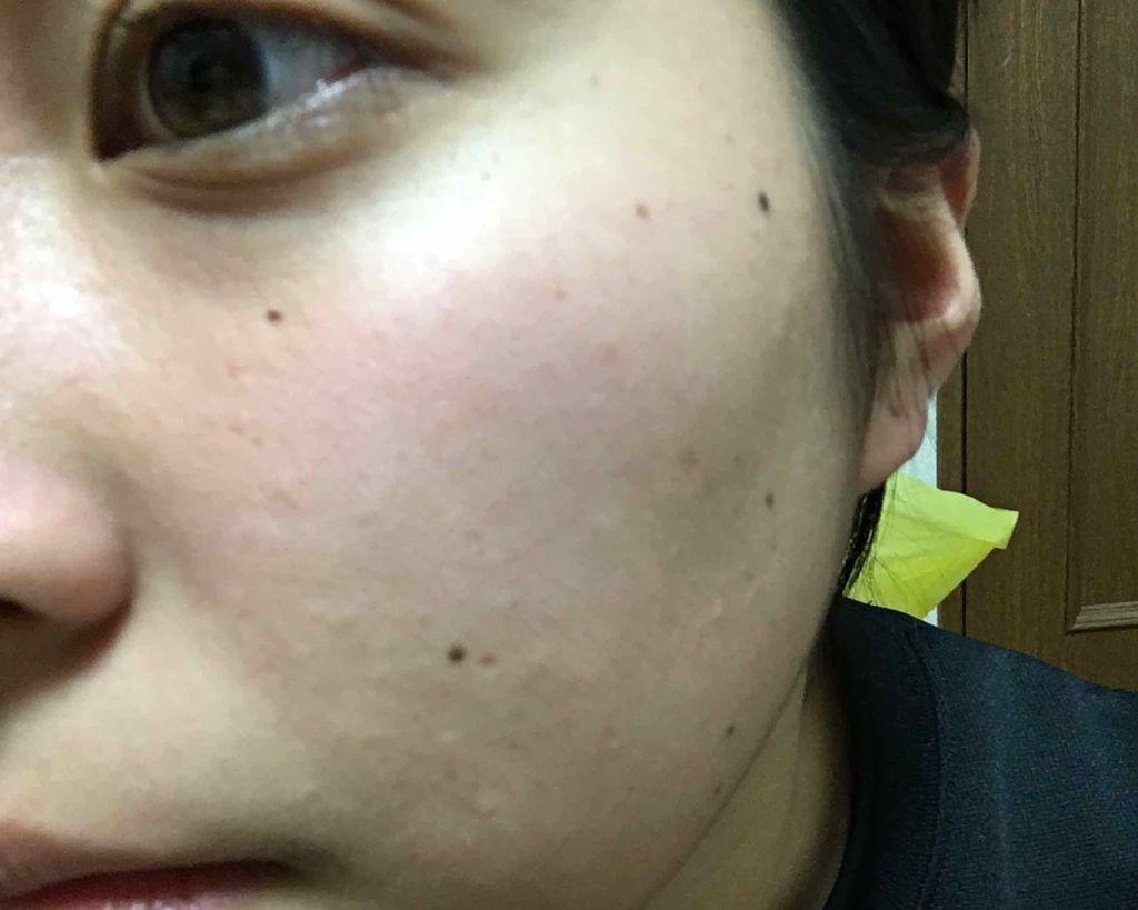 ピュア ナチュラル エッセンスローション ライト/pdc/乳液を使ったクチコミ(3枚目)