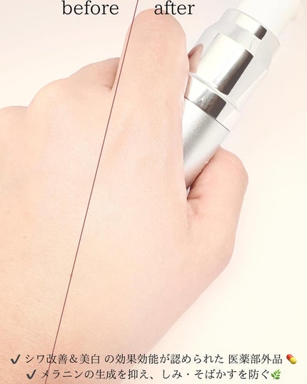 スキンセラムファンデーション/qiolo/リキッドファンデーションを使ったクチコミ(4枚目)