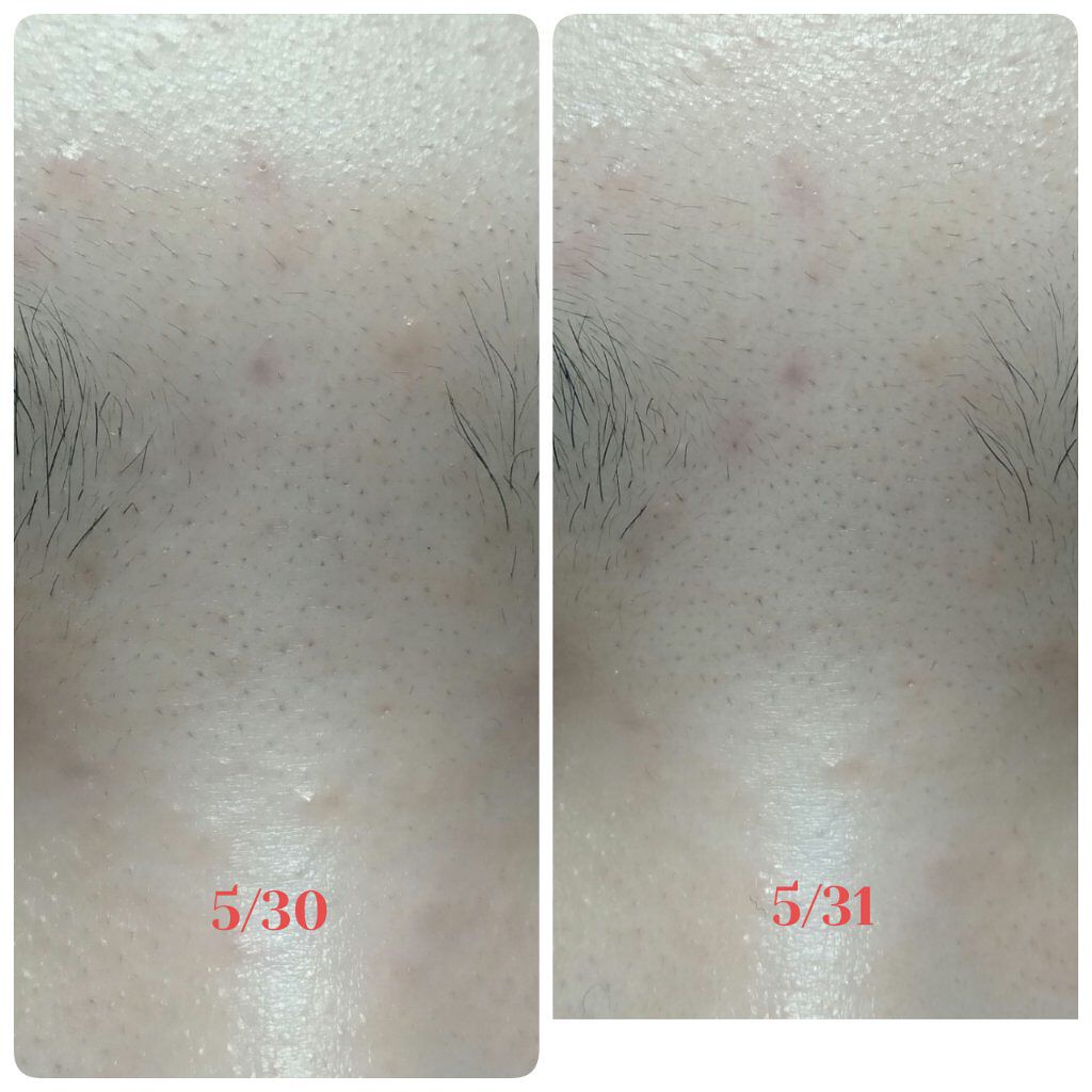 ヘルプミー! ダクトパッド/One-day's you/トナーパッドを使ったクチコミ(4枚目)