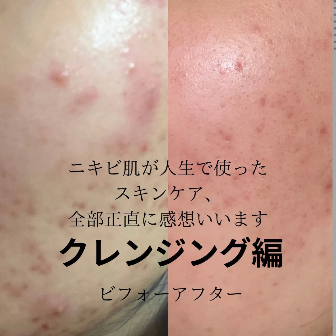 DHC 薬用ディープクレンジングオイル/DHC/オイルクレンジングを使ったクチコミ(1枚目)