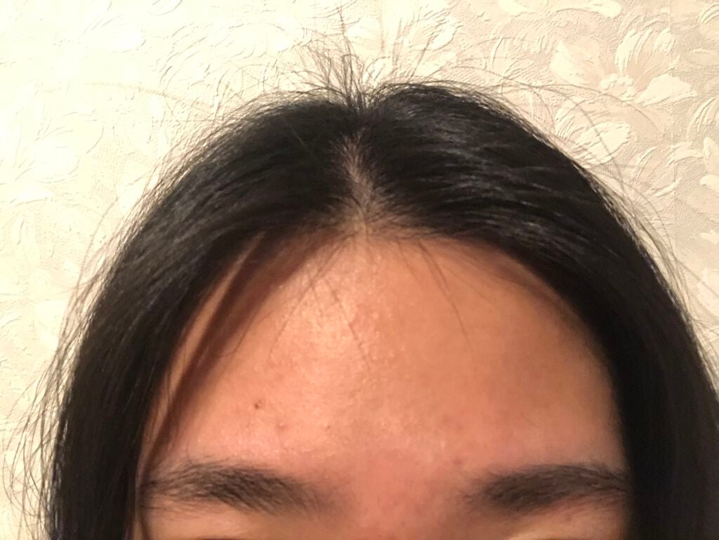 艶肌ドロップ/ラッシュ/美容液を使ったクチコミ(2枚目)