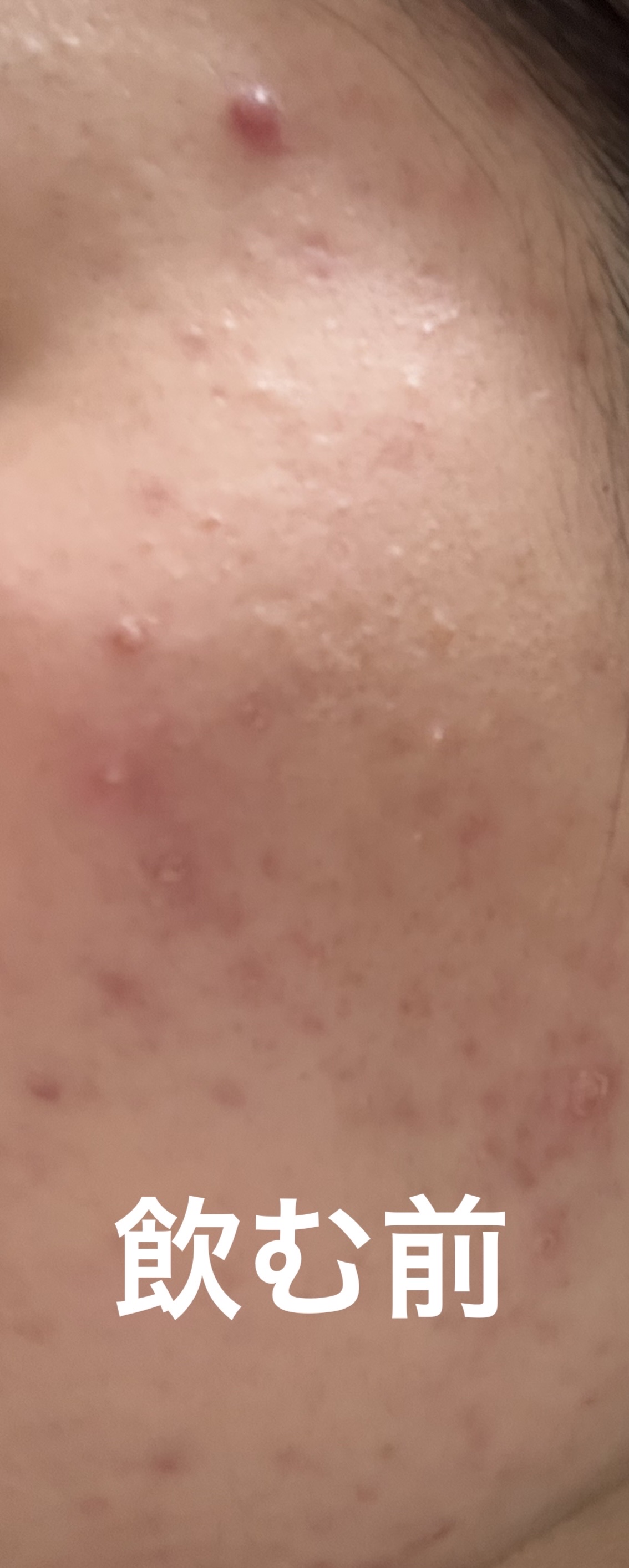 ペア漢方エキス錠（医薬品）/ペア/その他を使ったクチコミ（3枚目）