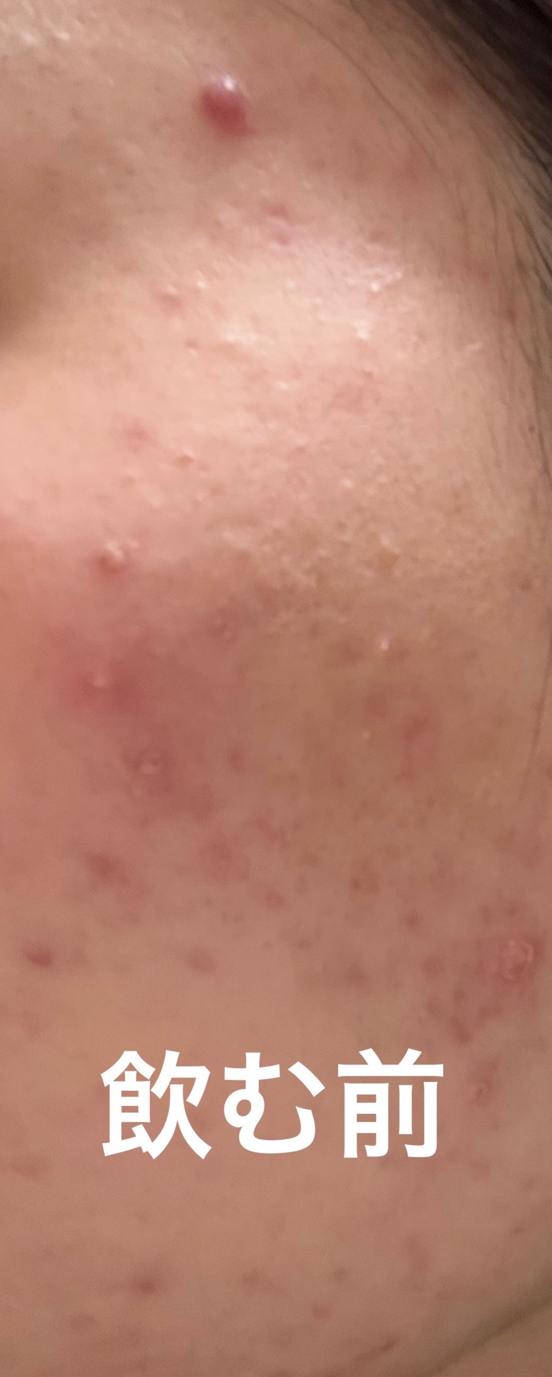 ペア漢方エキス錠(医薬品)/ペア/その他を使ったクチコミ(3枚目)