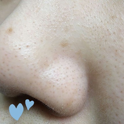 ソフィーナ iP ポア クリアリング ジェル ウォッシュ/SOFINA iP/その他洗顔料を使ったクチコミ(10枚目)