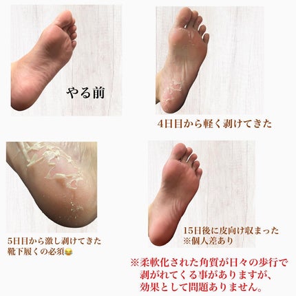 イージーパックDP60分タイプ/ベビーフット/レッグ・フットケアを使ったクチコミ(3枚目)