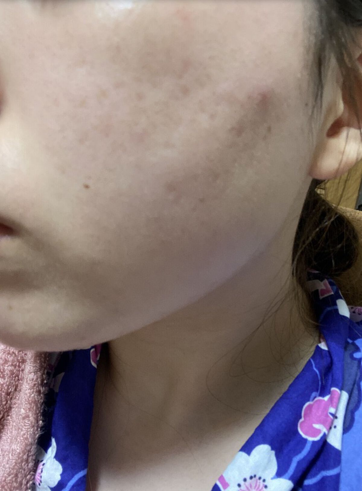 ガラクナイアシン エッセンスマスク/manyo/シートマスク・パックを使ったクチコミ（3枚目）