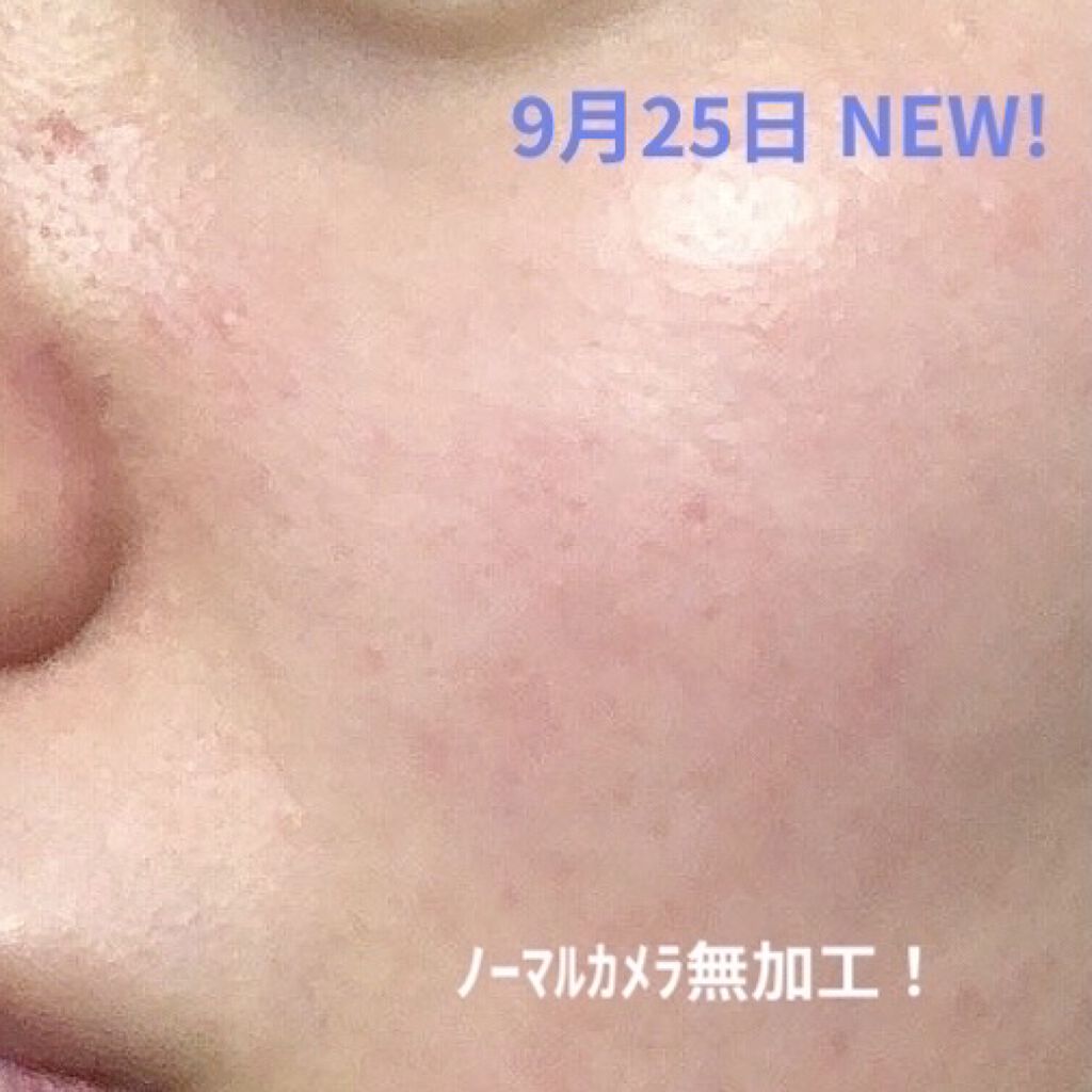 ガラクナイアシン2.0エッセンス/manyo/美容液を使ったクチコミ（2枚目）