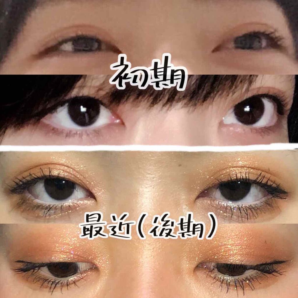 のび〜る アイテープ 両面テープタイプ/DAISO/二重まぶた用アイテムを使ったクチコミ(4枚目)