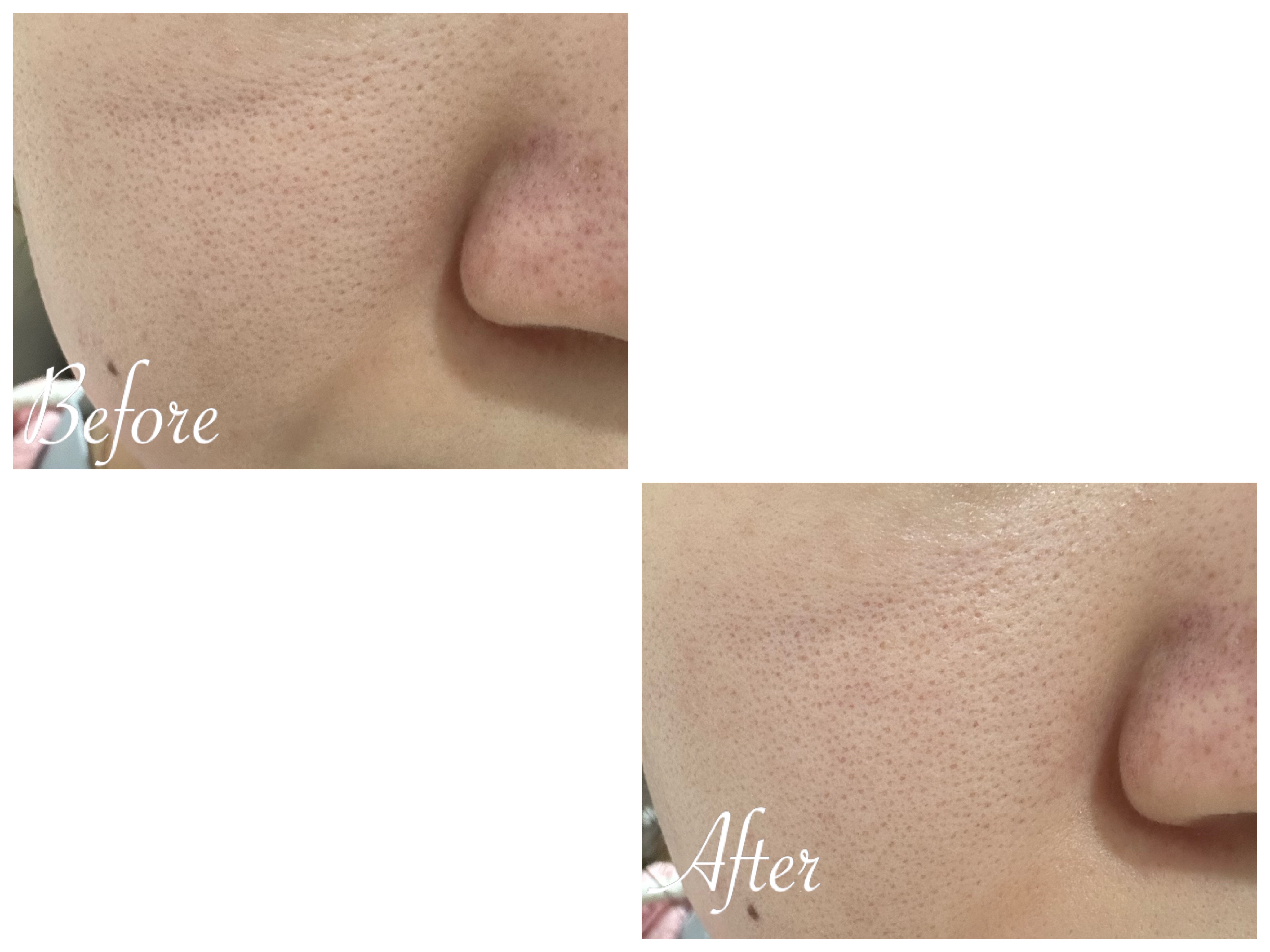 マスクアウェイクン/シーボン．/洗い流すパック・マスクを使ったクチコミ（3枚目）