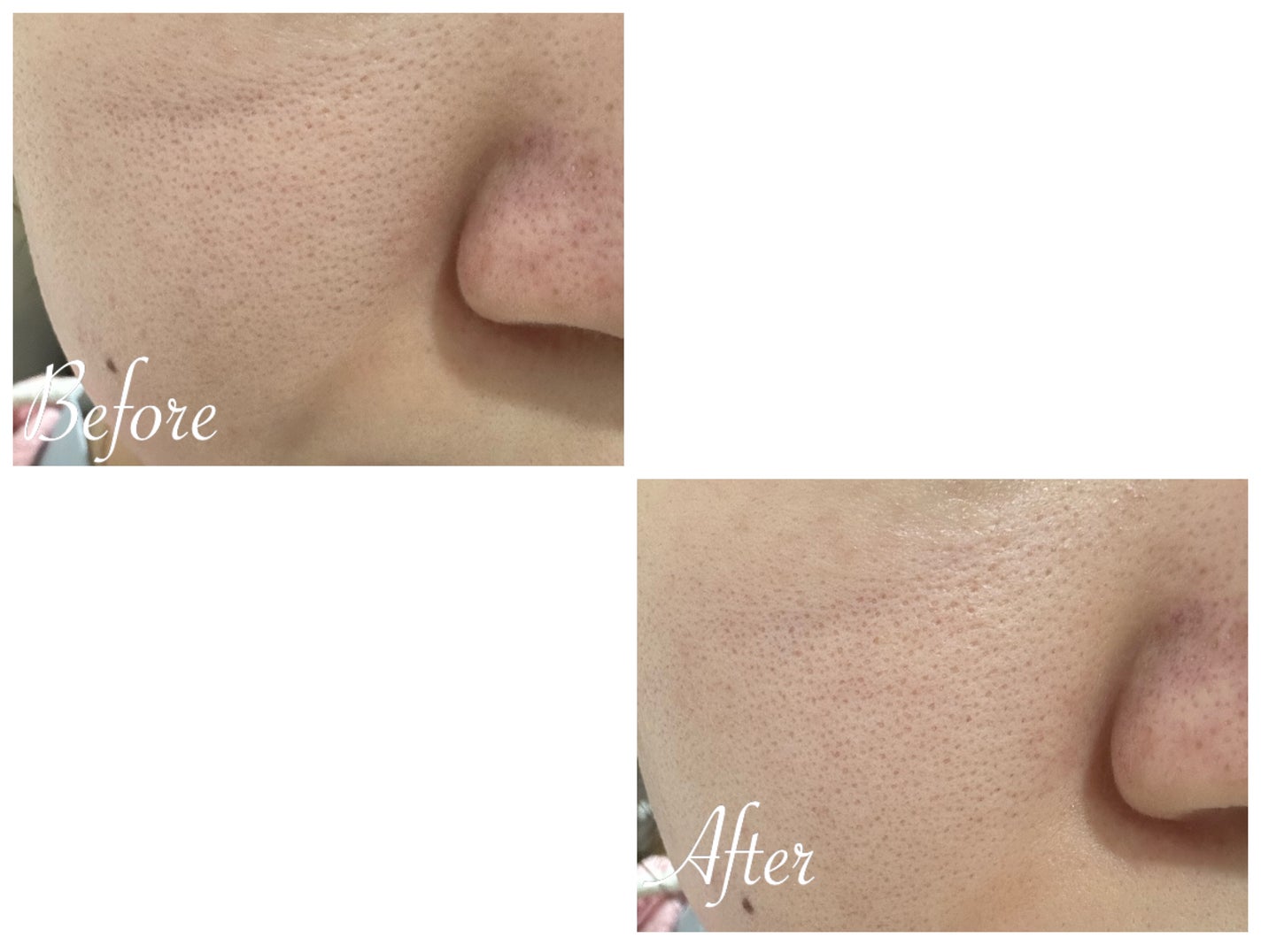 マスクアウェイクン/シーボン./洗い流すパック・マスクを使ったクチコミ(3枚目)