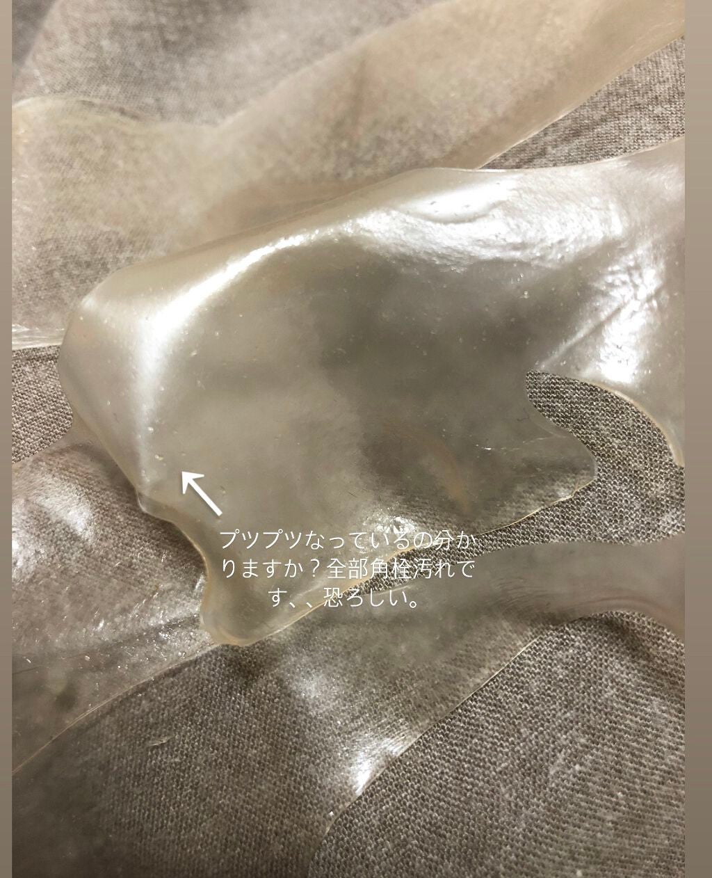 nanako on LIPS 「夜貼って朝剥がすパックに角栓汚れたくさん取れてびっくりしました..」(6枚目)