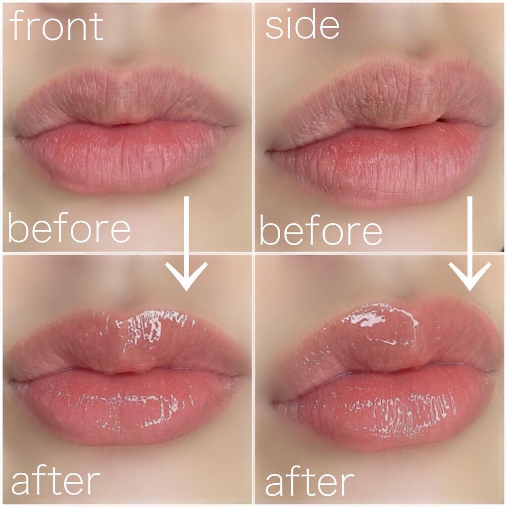 【旧】ディオール アディクト リップ マキシマイザー/Dior/リップグロスを使ったクチコミ（3枚目）