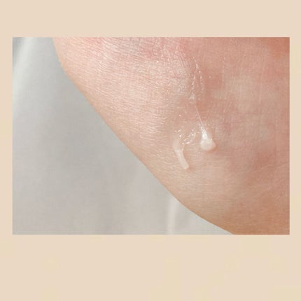 モアリップ N (医薬品)/資生堂薬品/その他を使ったクチコミ(3枚目)