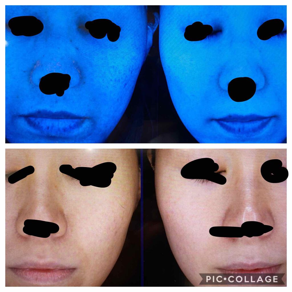 ミラミックス/ZO Skin Health/フェイスクリームを使ったクチコミ（2枚目）