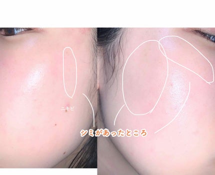 グリーンタンジェリン ビタC ダークスポットケアセラム/goodal/美容液を使ったクチコミ(2枚目)