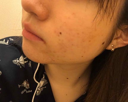 おやすみ美脚/SLIMWALK/着圧ソックス・レギンスを使ったクチコミ(4枚目)