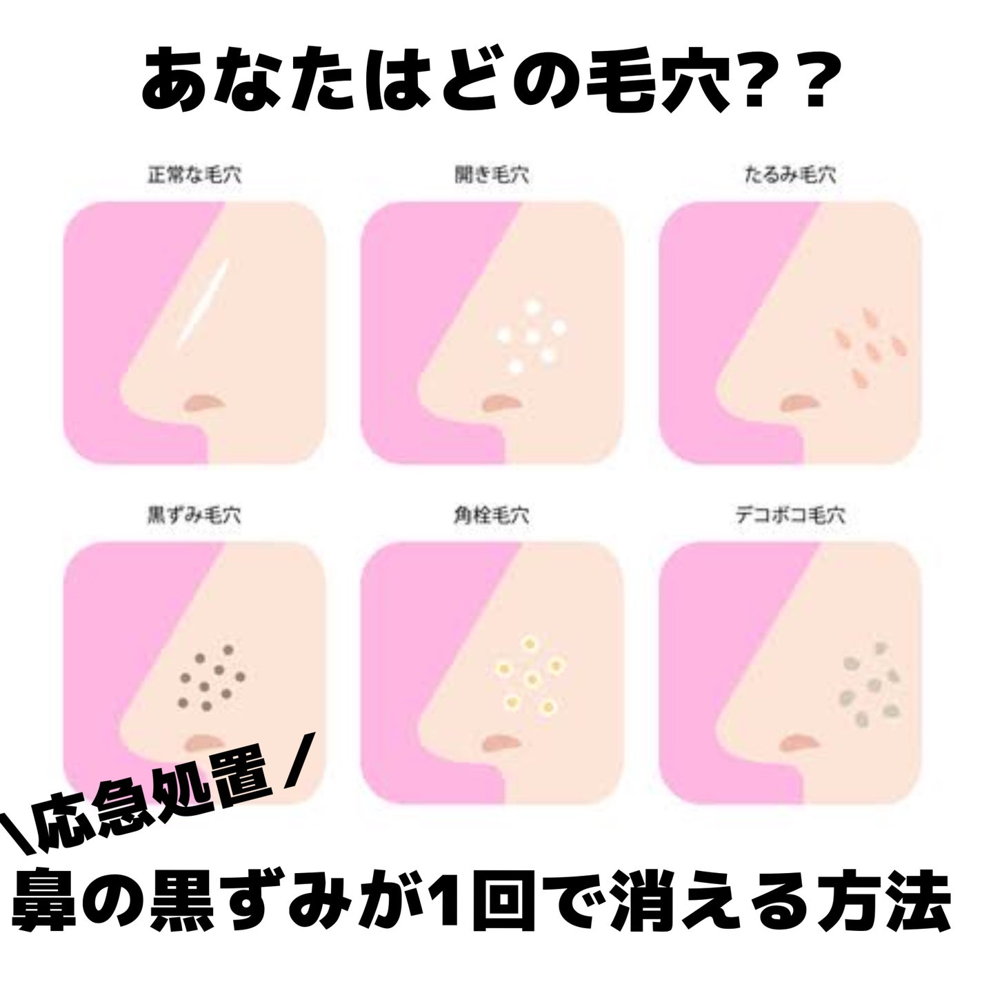 敏感肌用薬用美白乳液/無印良品/乳液を使ったクチコミ(1枚目)