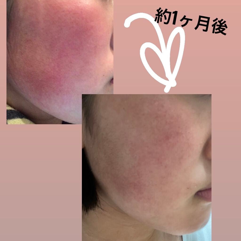 ノーセバム ミネラルパクト N/innisfree/プレストパウダーを使ったクチコミ(2枚目)