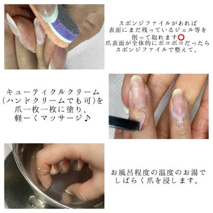 Suzukið§žð§ž on LIPS ã以åãã³ãã±ã¢ãèŒããæã詳ããçªã®ã±ã¢æ¹æ³çãèŒãããïŒãšæ..ãïŒ5æç®ïŒ