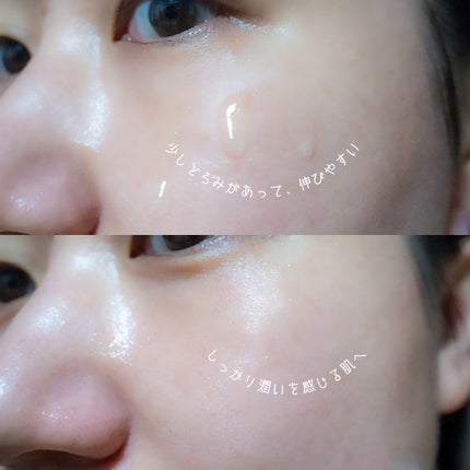 ミシャ タイムレボリューション レチ500ショット美容液/MISSHA/美容液を使ったクチコミ(4枚目)