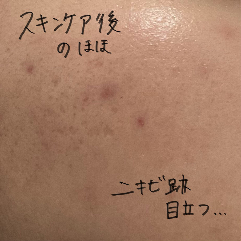 セラムフィット フルカバー グロークッション/ByUR/クッションファンデーションを使ったクチコミ（2枚目）