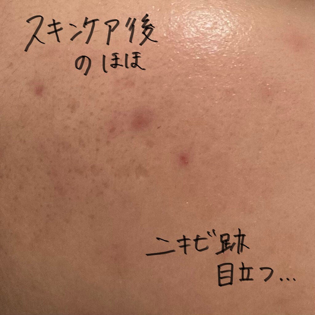 セラムフィット フルカバー グロークッション/ByUR/クッションファンデーションを使ったクチコミ(2枚目)