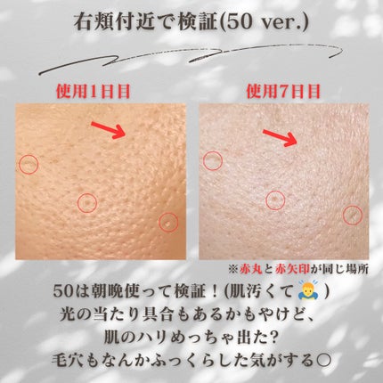 マイルドリードルショット50/VT/美容液を使ったクチコミ(4枚目)