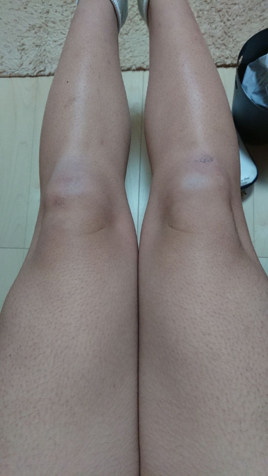 zuzun on LIPS 「皆さんに質問です私は中学三年生で身長159センチ体重52キロ(..」(1枚目)