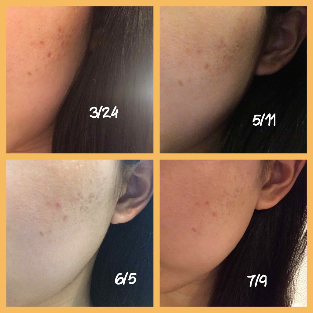 美白乳液 W/ちふれ/乳液を使ったクチコミ（3枚目）