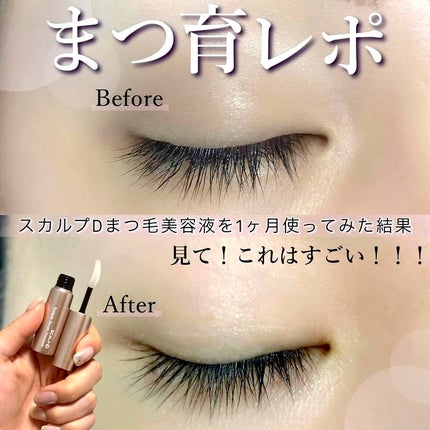 スカルプD アイラッシュセラム プレミアム/アンファー(スカルプD)/まつげ美容液を使ったクチコミ(1枚目)