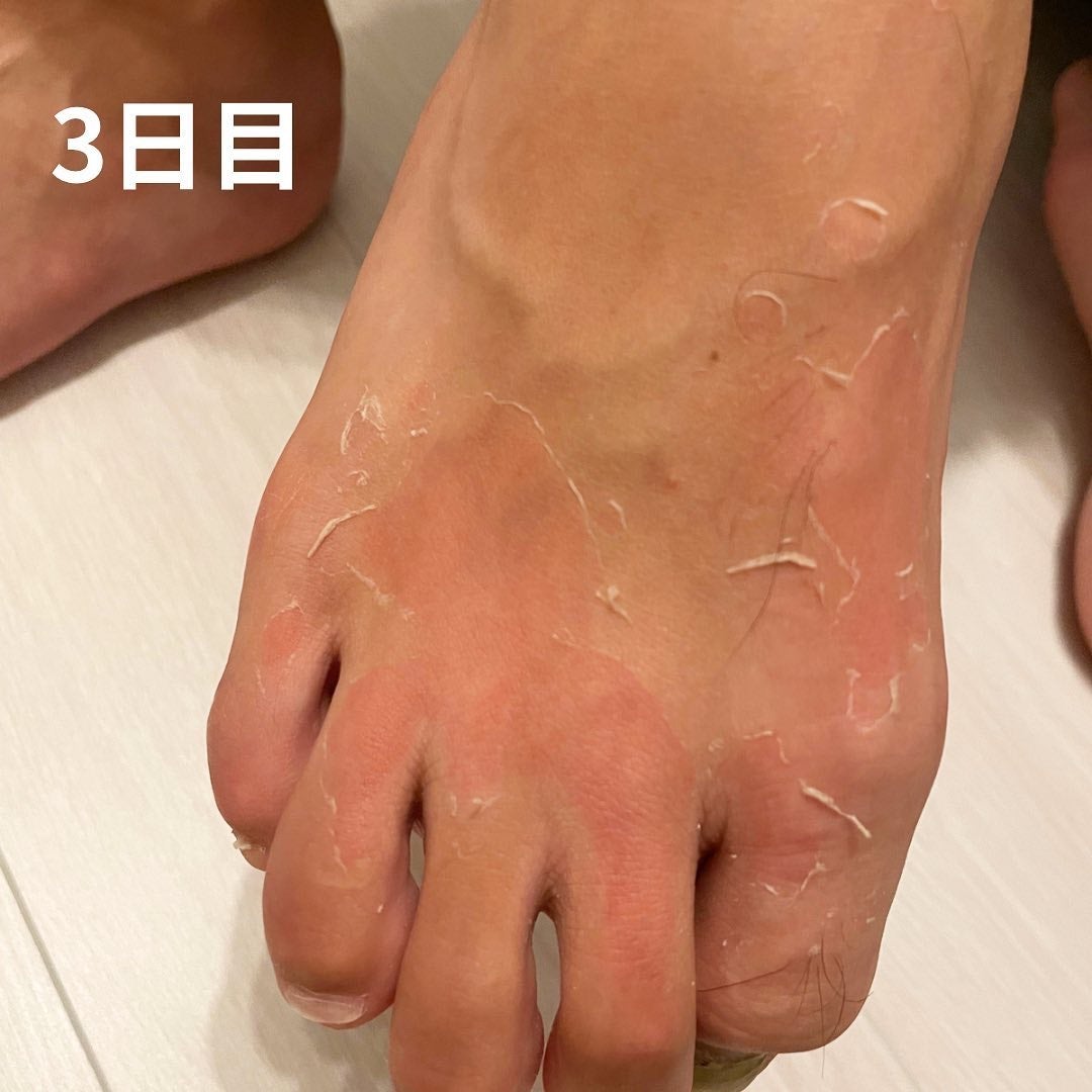 あしやすめ 足裏角質ケアパック/鎌倉ライフ/レッグ・フットケアを使ったクチコミ(5枚目)