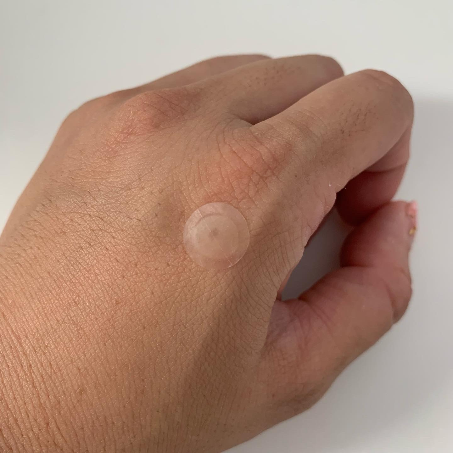 ゼロスポットパッチCICA｜Today’s Cosmeの効果に関する口コミ この度はPOPSKIN様より Zero spot patch