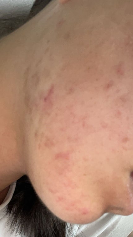 を使ったクチコミ(3枚目)