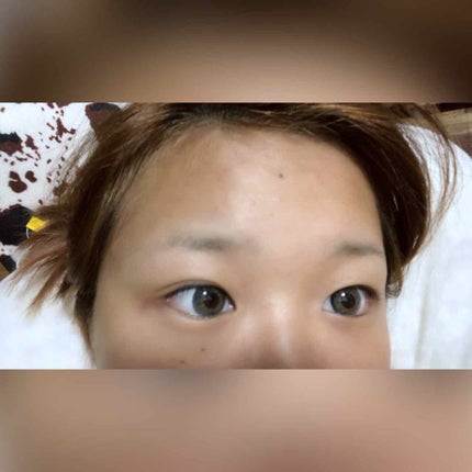 アイテープ(絆創膏タイプ、レギュラー、70枚)/DAISO/二重まぶた用アイテムを使ったクチコミ(2枚目)