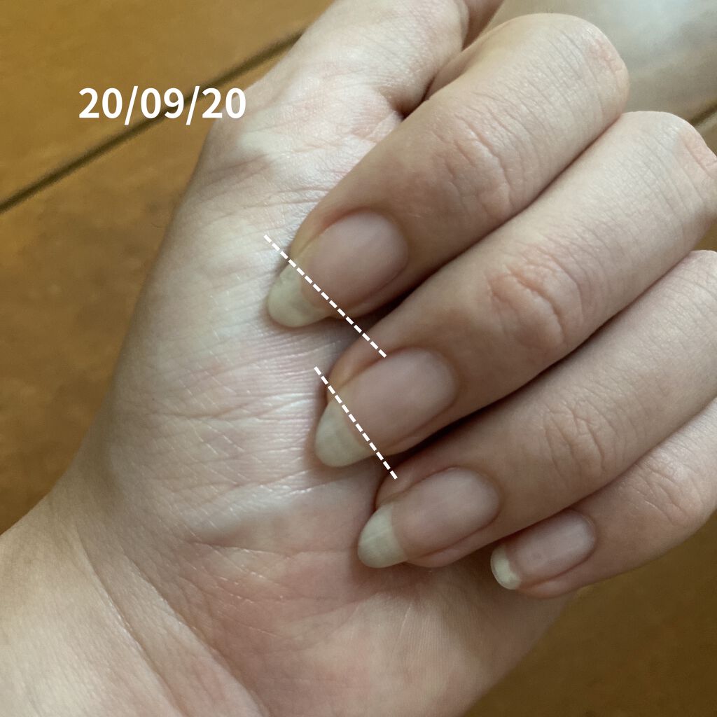 キューティクルオイル/HOMEI/ネイルオイル・トリートメントを使ったクチコミ（3枚目）