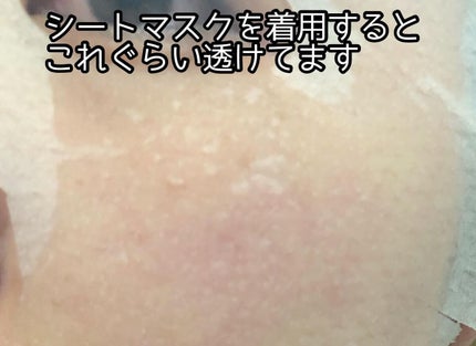 毛穴小町 テカリ源治 マスク/クリアターン/シートマスク・パックを使ったクチコミ(6枚目)