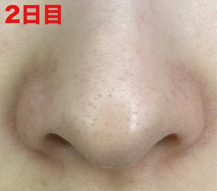 ディープクリア酵素洗顔 /メラノCC/洗顔フォームを使ったクチコミ(4枚目)