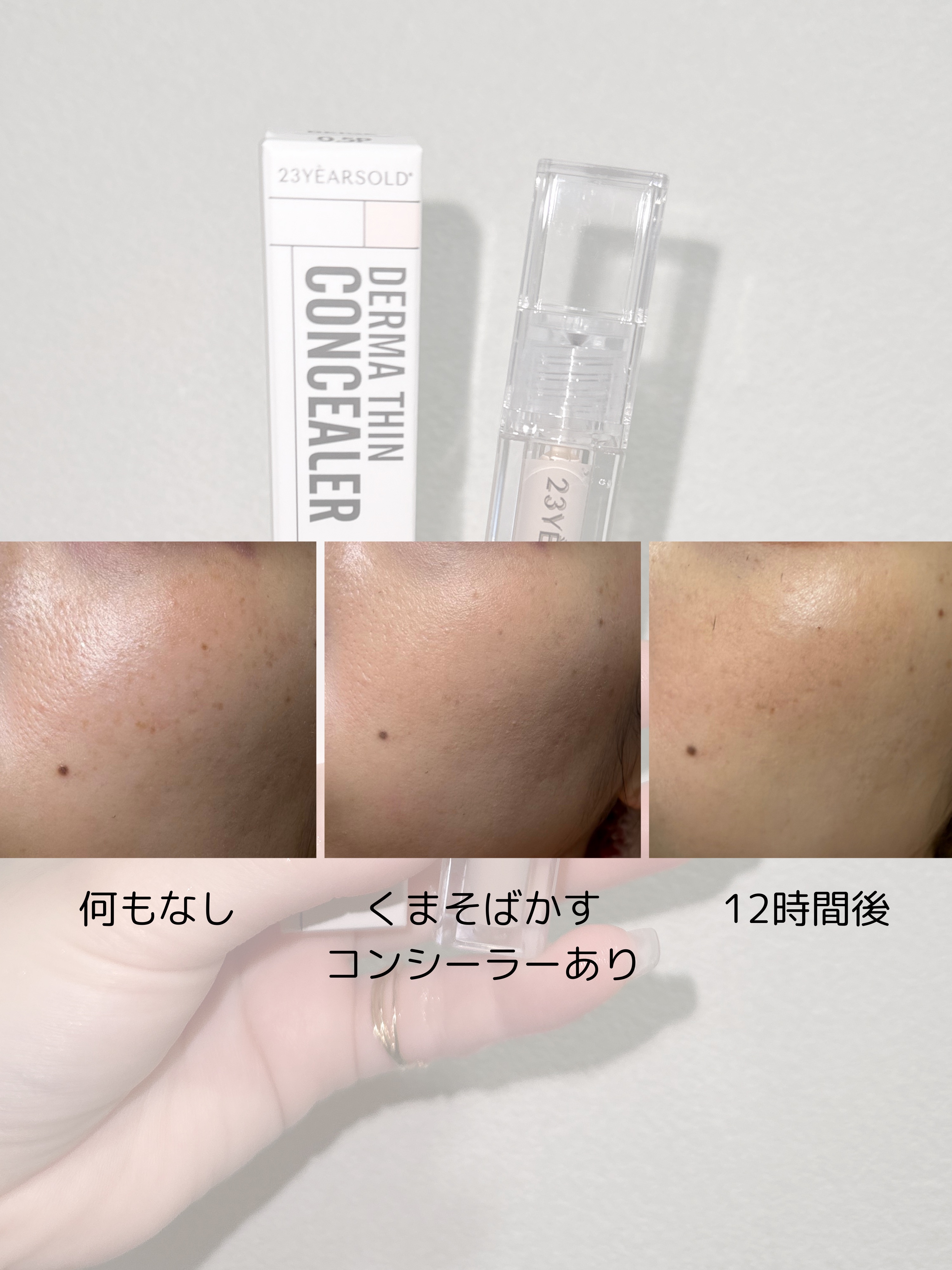 ダーマシンコンシーラー/23years old/リキッドコンシーラーを使ったクチコミ（2枚目）