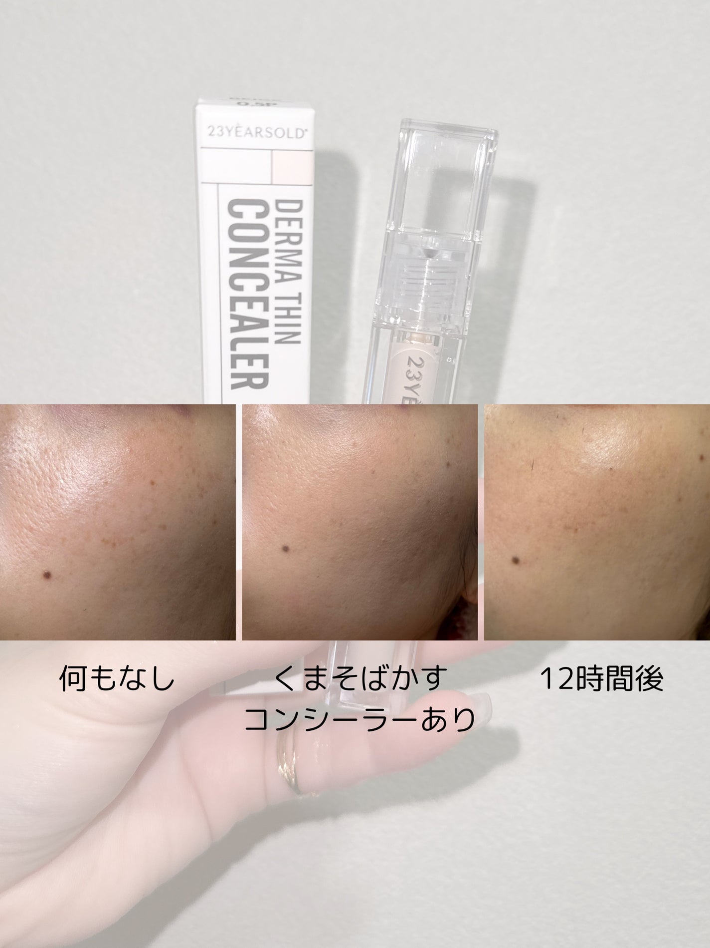 ダーマシンコンシーラー/23years old/リキッドコンシーラーを使ったクチコミ(2枚目)