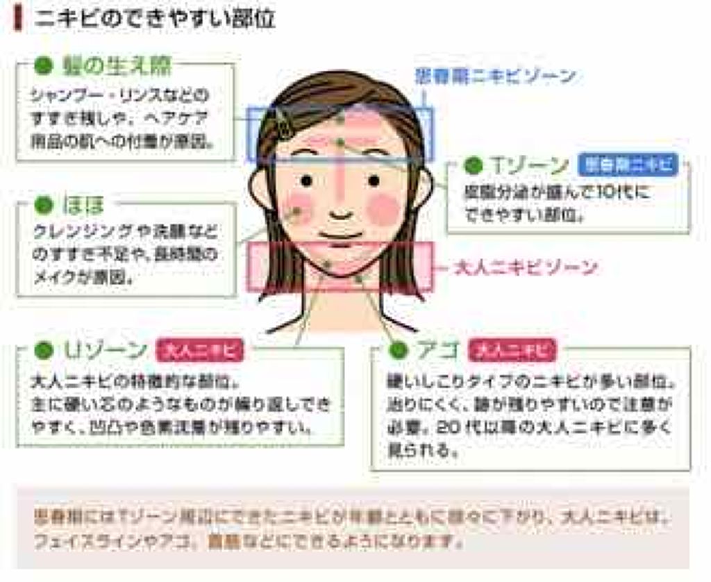 COCO on LIPS 「こんばんはーあきです!今日は、みんなが嫌いなニキビについて教え..」(2枚目)