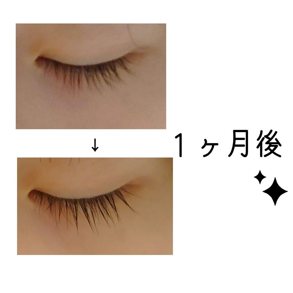 スカルプD ボーテ ピュアフリーアイラッシュセラム/アンファー(スカルプD)/まつげ美容液を使ったクチコミ(2枚目)