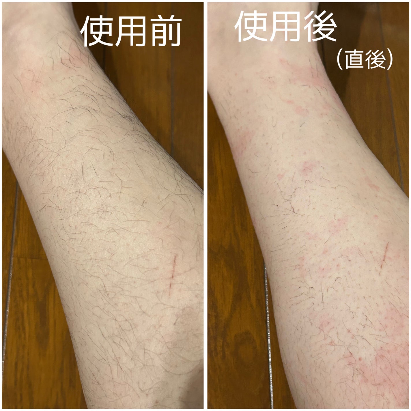 除毛クリーム リッチオイルケア/エピラット/除毛クリームを使ったクチコミ(8枚目)