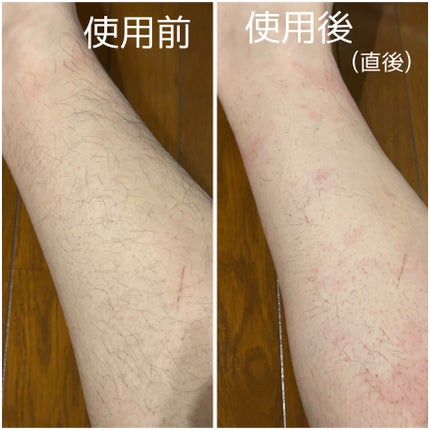 除毛クリーム リッチオイルケア/エピラット/除毛クリームを使ったクチコミ(8枚目)