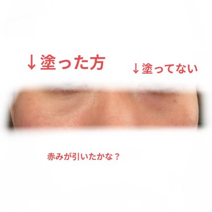 スポッツカバー ファウンデイション/SHISEIDO/クリームコンシーラーを使ったクチコミ(5枚目)